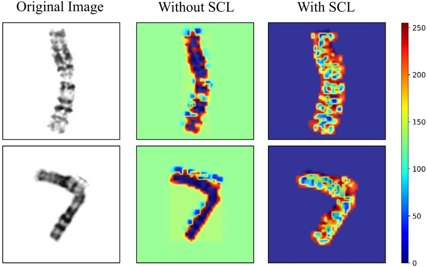 SCL